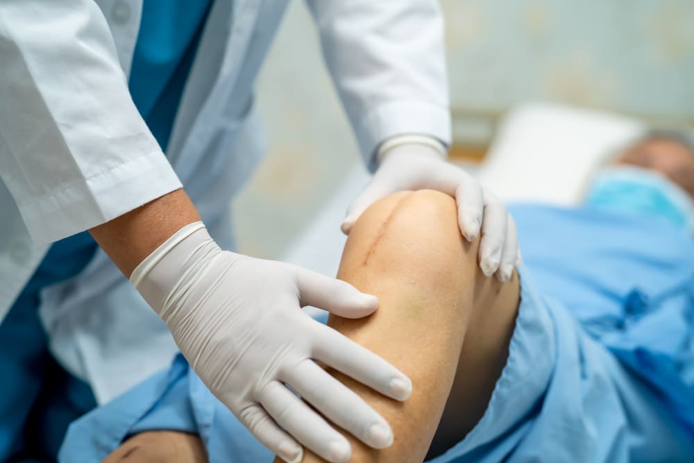 Knee replacement in Bangalore